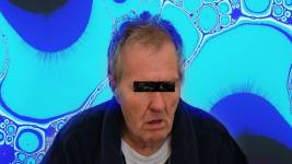 Alzhemier Nedir