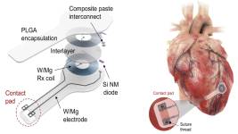 pacemaker structure heart