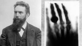 Bilim Tarihinde Bugün : Wilhelm Conrad Röntgen Doğdu Wilhelm Conrad Rontgen
