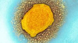 Amerika'da Monkeypox Son Durum Nedir?