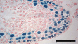 Dondurulmuş Testis Dokusu Yirmi Yıl Sonra da Yaşayabilir Dondurulmuş Testis Dokusu Yirmi Yıl Sonra da Yaşayabilir